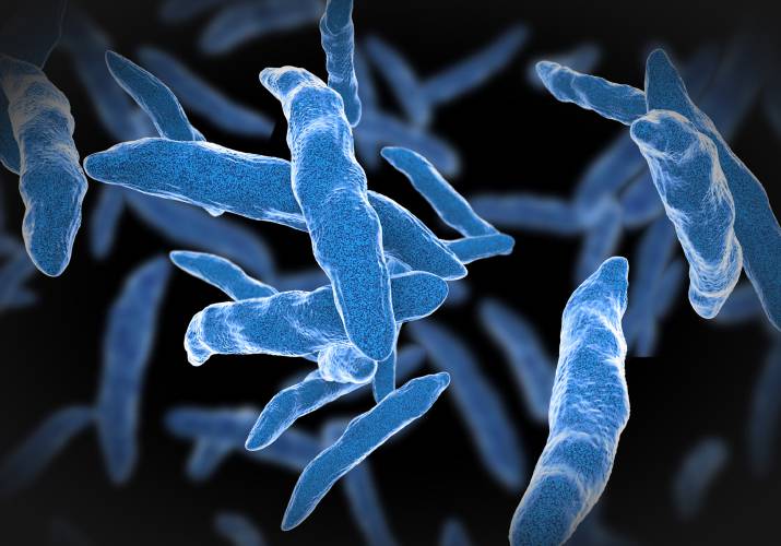 Tuberculosis is caused by bacteria that spread from person to person through microscopic droplets released into the air. Tuberculosis is caused by bacteria that spread from person to person through microscopic droplets released into the air.